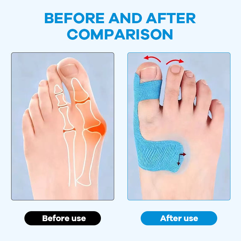 Bande de Soutien Pré-Découpée pour Hallux Valgus