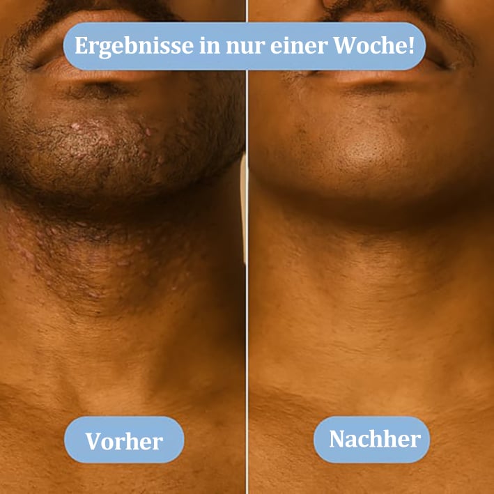 🔥🍃 Glättende Lösung zur Behandlung eingewachsener Haare